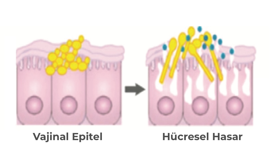 Candida Tedavisi - Candiflorex